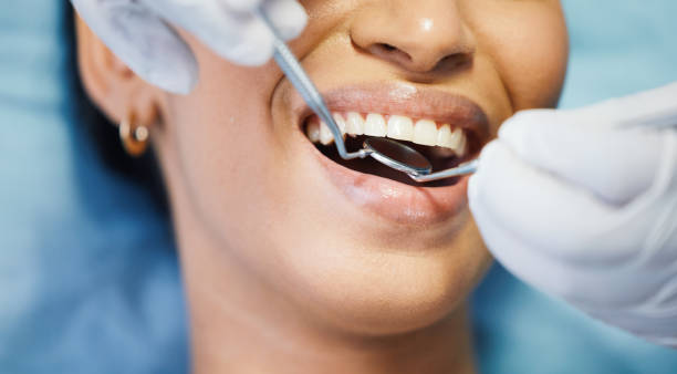 Best Emergency Root Canal Treatment in Rochelle, GA
