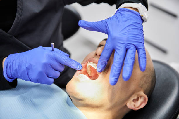 Best Emergency Wisdom Teeth Removal in Rochelle, GA